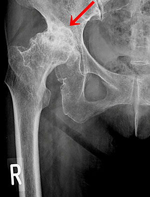 �S�l�H�Ҋ֐ߒu���p ��p�O