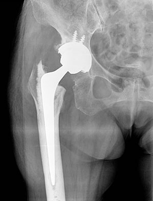 �S�l�H�Ҋ֐ߒu���p ��p��