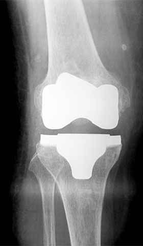 �S�l�H�G�֐ߒu���p ��p��