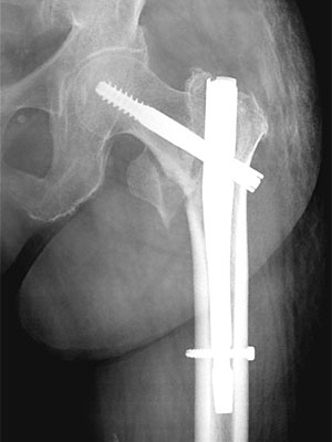 �Ҋ֐ߌz���O�����܁i��-�l�C���j