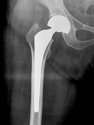 �Ҋ֐ߌz���������܁i�l�H�����j