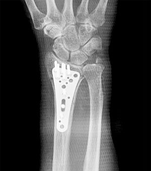 �R�[���X����